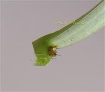  Leaf - Axillary glands